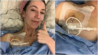 ♡ Getting a Hickman Line amp Starting TPN 251018  Amys Life ♡ [upl. by Pfosi]