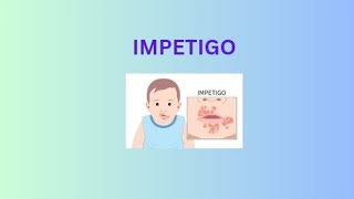 quotUnderstanding Impetigo Causes Symptoms and Treatmentquot [upl. by Annavoeg25]