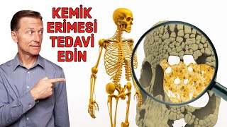 Kemik Erimesi Osteoporoz Kalsiyum Eksikliği Değildir – Osteoporoz Tedavileri  DrBerg Türkçe [upl. by Rafaelle793]