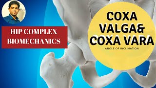 Angle of Inclination Coxa Valga  Coxa Vara Hip Biomechanics [upl. by Nyladnek]