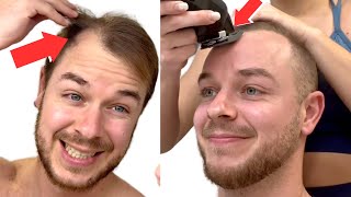 SHAVING My RECEDING HAIRLINE To A Grade 1 BUZZ CUT Transformation [upl. by Yorgerg348]