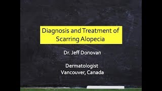 Diagnosis amp Treatment Scarring Alopecia [upl. by Addi]