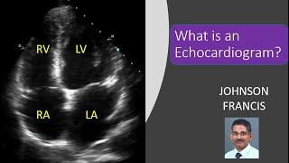 What is an Echocardiogram [upl. by Nyladam602]