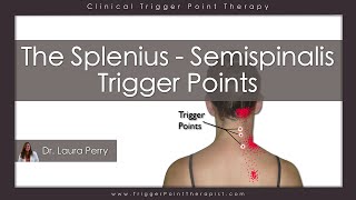 The Splenius and Semispinalis Trigger Points [upl. by Eda]