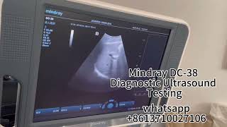 Mindray DC38 Diagnostic Ultrasound System Testing [upl. by Evan]