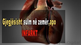 Infarkti Sulmi ne Zemer 3D [upl. by Nesyrb]