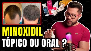 MINOXIDIL TÓPICO OU ORAL QUAL É MELHOR [upl. by Nnil]