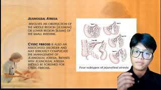 NCM 109 INTESTINAL ATRESIA amp STENOSIS IMPERFORATE ANUS [upl. by Atiuqam]