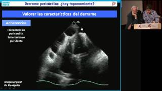 Máster de Técnicos en Ecocardiografía Tutoría 5 [upl. by Ikairik938]