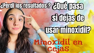 ¿Se mantienen los resultados si dejas de usar MINOXIDIL  EFECTOS SECUNDARIOS cejas y entradas [upl. by Jeramie]