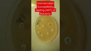 Antimicrobial Susceptibility Testing of Bacteria on MullerHinton Agar [upl. by Pennie]