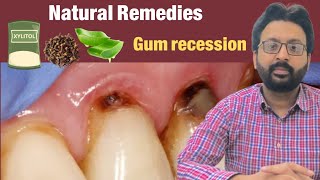 Grow Back Receding Gums Naturally [upl. by Comstock820]