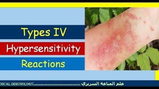 Lecture 7 Type IV Hypersensitivity Reaction [upl. by Ardnad]