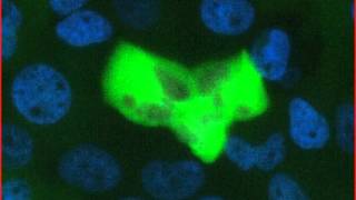 Mitotic catastrophe triggered in human cancer cells by the viral protein apoptin  movie B [upl. by Trimble]