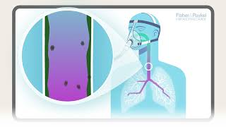 How does humidity support the lungs  FampP Healthcare [upl. by Sheryle]