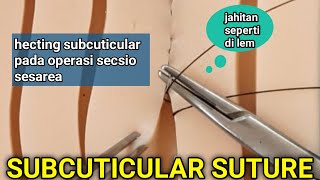 CARA TEKNIK HECTING SUBCUTICULAR SUTURE PADA OPERASI SECSIO SECAREA SEPERTI JAHIT LEM [upl. by Akemihs481]