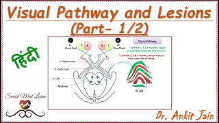 Visual Pathway and Lesions Part12 in Hindi  Visual field defects Anatomy Simplified [upl. by Warner]