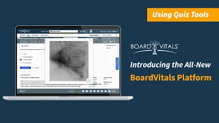 NEW BoardVitals Platform  Using Quiz Tools [upl. by Wallis]