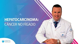 Hepatocarcinoma Câncer no Fígado [upl. by Aihsram]