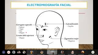 Electrocardiograma y Electromiograma [upl. by Nicko]