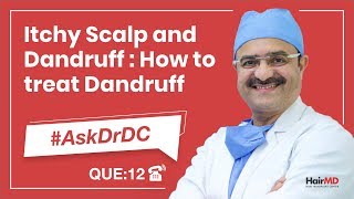 Itchy Scalp amp Dandruff How To Treat Dandruffडैंड्रफ का इलाज कैसे करें AskDrDc Ep12  In HINDI [upl. by Dhruv]