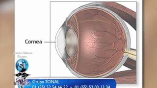 PROBLEMAS DE CORNEA CON HOMEOPATÍA [upl. by Yrrehs]