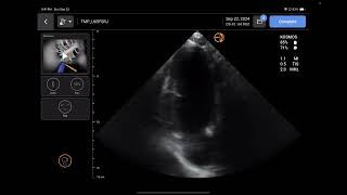 Handheld Ultrasound Review KOSMOS by Echonous [upl. by Blaise]