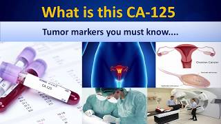 What is this CA 125CA125BiochemistrytestsMLSCancertests [upl. by Aihselat]