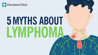 Debunking 5 Myths About Lymphoma [upl. by Christan]