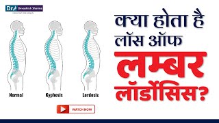 क्या होता है Loss of Lumbar Lordosis Spine Treatment In Noida DelhiNCR amp AgraDr Devashish Sharma [upl. by Arbe]