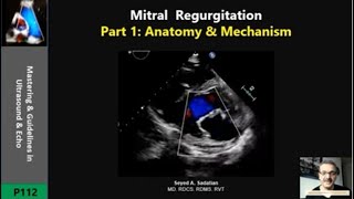 Mitral Regurgitation Part 1 Anatomy amp Mechanism [upl. by Nugesulo]