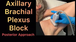 Axillary Brachial Plexus Block  posterior approach step by step easy and simple [upl. by Nattirb]