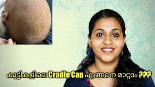 How to Cure Cradle Cap in Babies [upl. by Alimaj]