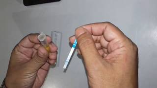 HBsAg Test Strip Method  Hepatitis B Virus Test [upl. by Urbain571]