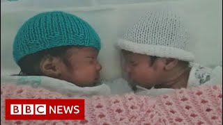 Woman in Covid coma gives birth to twins  BBC News [upl. by Brittan]