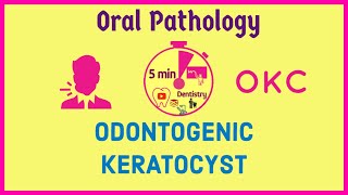 ODONTOGENIC KERATOCYST  OKC  ORAL PATHOLOGY  Exam notes  5mD [upl. by Retsev]