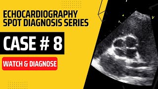 Case 8 Echocardiography Spot Diagnosis Case Series echocardiography echo cardiology [upl. by Ares]