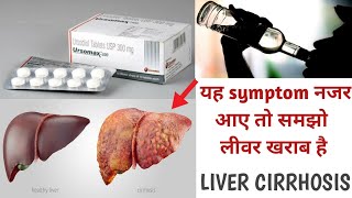 Ursomax 300 TabletUrsodeoxycholic Acidयह symptom नजर आए तो समझो लीवर खराब हैUsesHow To Take [upl. by Bosson]