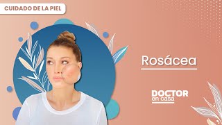 Causas y tratamiento de la rosacea [upl. by Annaujat]