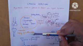 Cheese Reaction Unveiled Tyramine and MAO Inhibitors Explained [upl. by Gobert564]