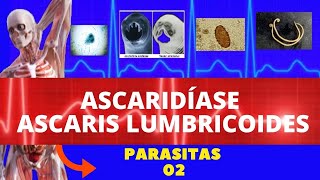 ASCARIDÍASE  ASCARIS LUMBRICOIDES LOMBRIGA  PARASITOLOGIA  INFECTOLOGIA [upl. by Neelyahs]