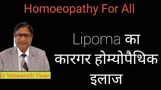 Lipoma  lipoma treatment In Homoeopathy in Hindi  स्किन की गाँठो का होम्योपैथिक इलाज lipoma [upl. by Hodosh]