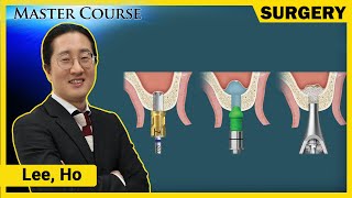 Master Course Season2  SURGERY Sinus Crestal ApproachCAS KIT [upl. by Felicity6]