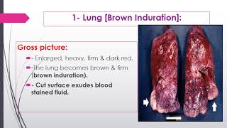 Hemodynamic disorders2 2024 [upl. by Starlin]