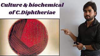 Corynebacterium  CDiphtheriae  Lab Diagnosis  Culture  Biochemicals By Abhishek sir [upl. by Danika356]