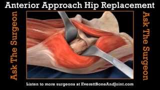 Anterior Approach for Total Hip Replacement [upl. by Atselec]