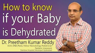 Hi9  How to know if your baby is Dehydrated  Dr Preetham Kumar Reddy  Consultant Pediatrician [upl. by Gefell756]