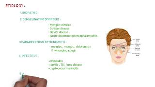 OPTIC NEURITIS LECTURE  NEET PG [upl. by Scarrow]