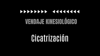 Vendaje Kinesiológico para cicatrización [upl. by Liemaj949]