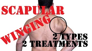 Scapular Winging Fix  Treat Medial And Lateral Winging [upl. by Brey595]